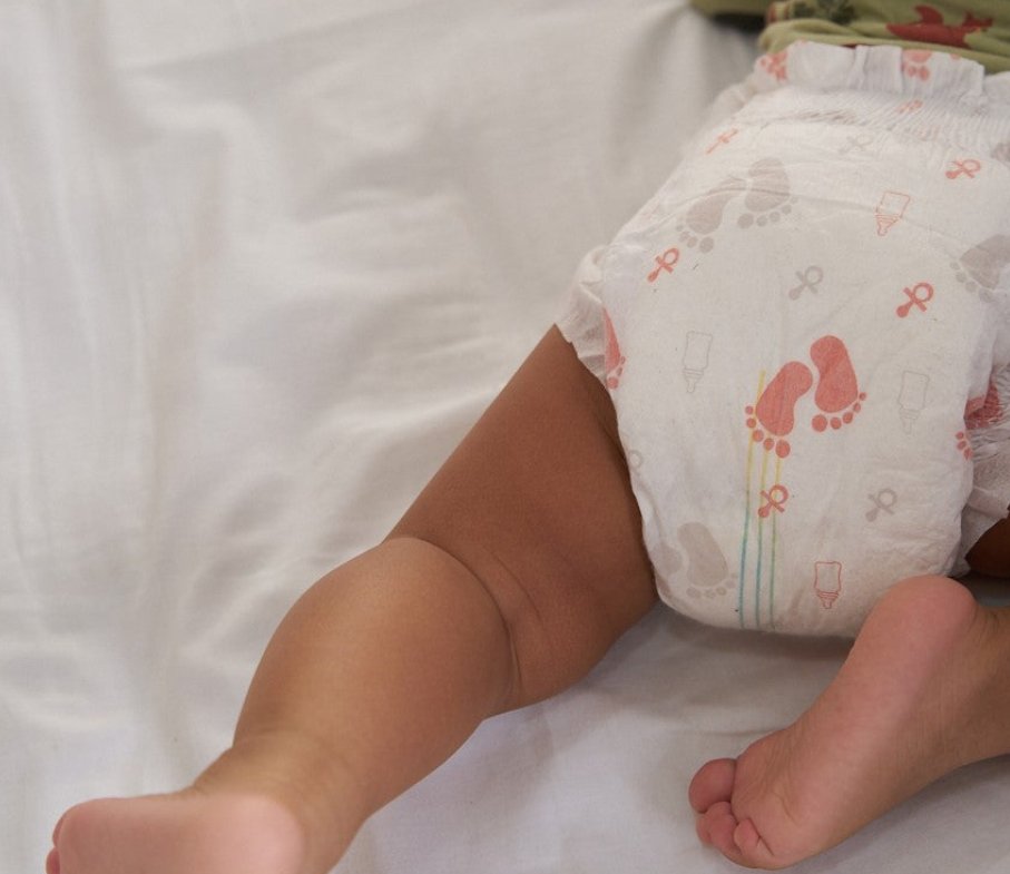 Milyen hatással van a pelenka a baba érzékeny bőrére?